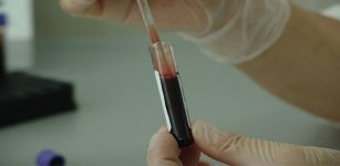 Blood tube examined by a doctor