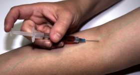 Injection of drug heroin into arm