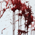 Interpreting Blood Stain Patterns: Science or Speculation?